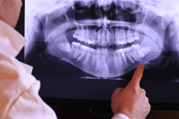 Best Broken or Cracked Tooth Emergency Dentist in Evansville, WY