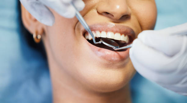Best Emergency Dentist for Knocked-Out Tooth in Evansville, WY